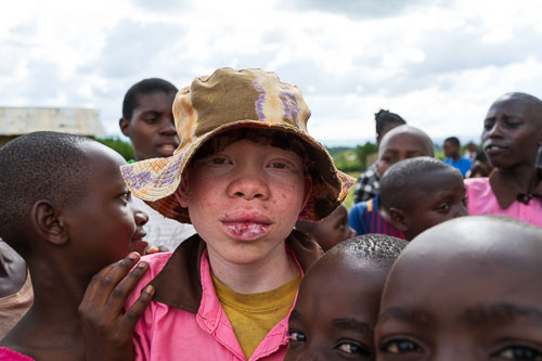 Albinos haben es auch in Uganda schwer 2023-10-19_14-57-13__Z725583.jpg